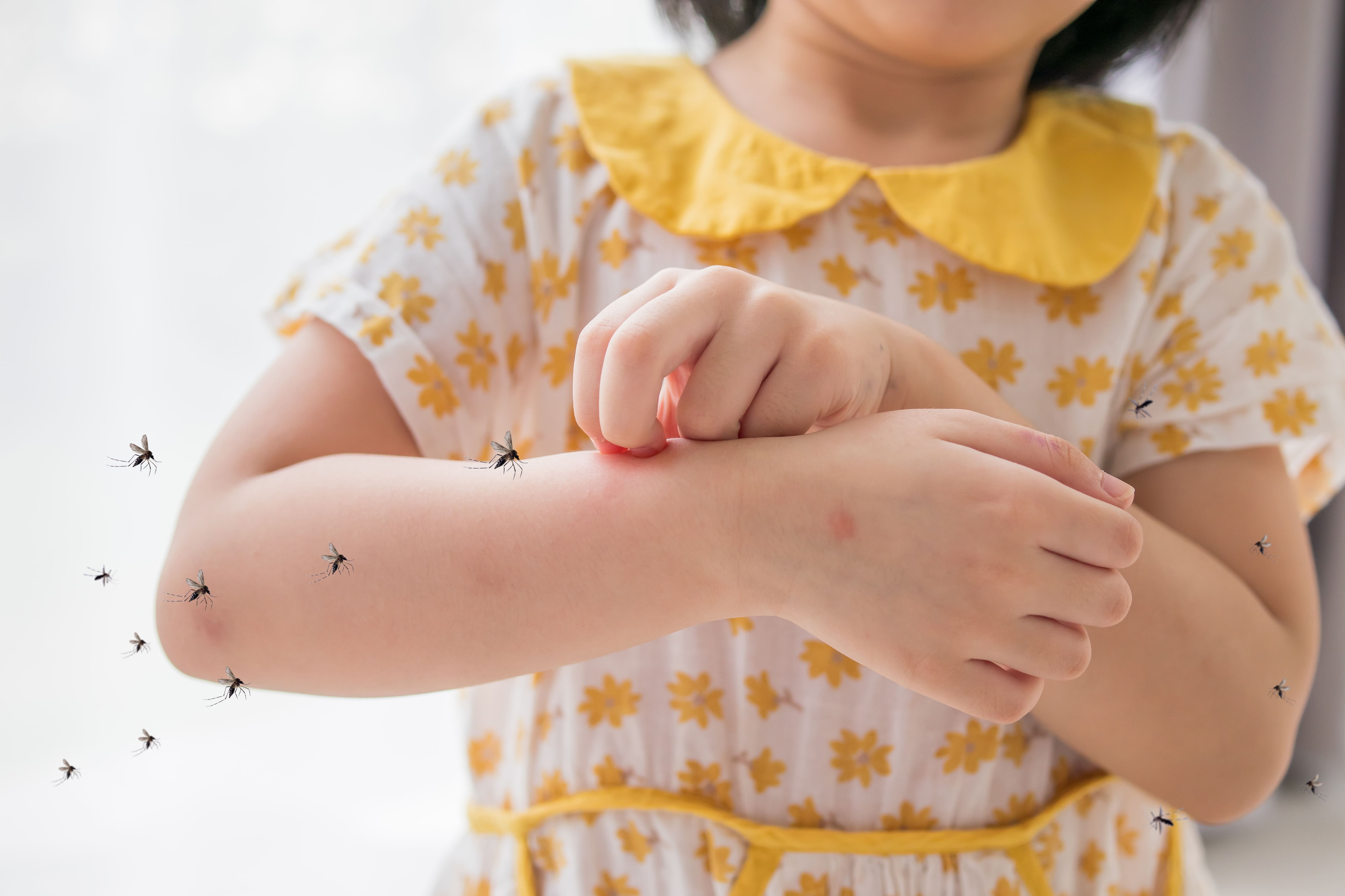 little-girl-has-skin-rash-allergy-itchy-her-arm-from-mosquito-bite